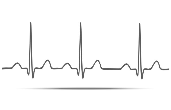Visita Cardiologica Elettrocardiogramma