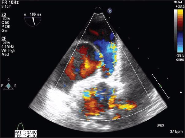 Visita Cardiologica Ecocardiogramma