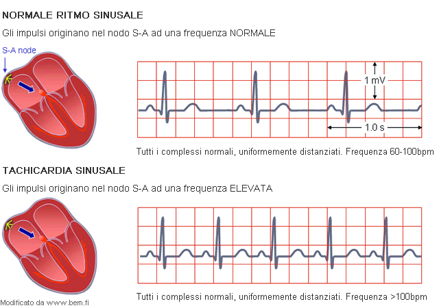 Visita Cardiologica le più comuni patologie indagate