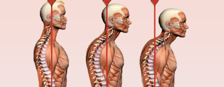 Rieducazione posturale: le applicazioni